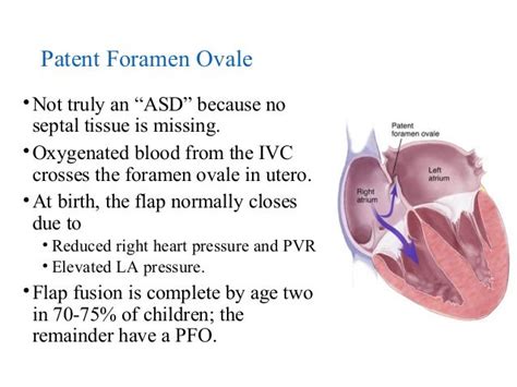 Atrial Septal Defects 16 3 15