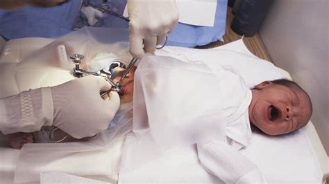 La Circoncision Aussi Importante Que La Vaccination Radio Canada