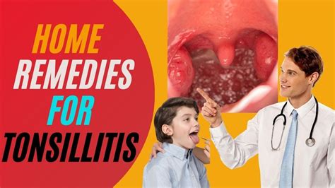 Tonsillitis Treatment At Home 3 Powerful Home Remedies For Tonsil
