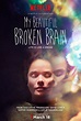 My Beautiful Broken Brain Reveals the Aftermath of a Brain Hemorrhage ...
