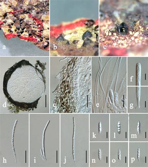 Aureobasidium Melanogenum Faceoffungi Number Fof 10609 Faces Of Fungi