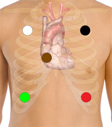 Lead Ecg Placement Mnemonic Google Search Nursing Information The