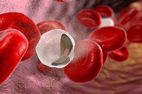 Therapeutic First For Cold Agglutinin Disease Haemolytic Anaemia