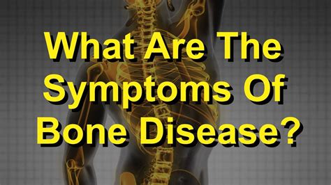 What Are The Symptoms Of Bone Disease Youtube