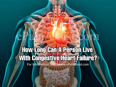 How Long Can You Live With Congestive Heart Failure