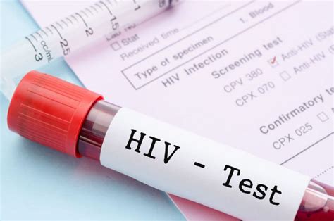 What Are The Early Signs Of Hiv And How To Know If You Are Positive