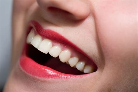 Get Brighter Teeth The Right Way Galleria Dental Aesthetics