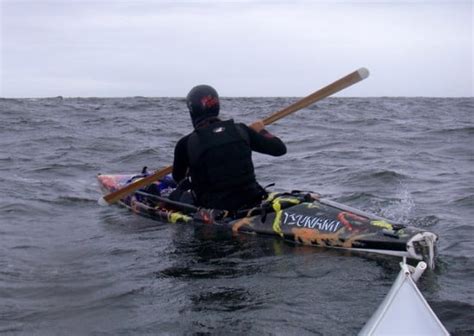 ~What famous person had a greenstick fracture ...