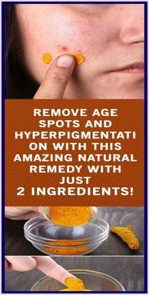 Remove Age Spots And Hyperpigmentation With This Amazing Natural Remedy