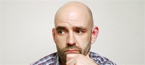 Male Pattern Baldness Everything You Need To Know Fashionbeans
