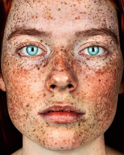 Lond Based Photographer Captures Gorgeous Photos Of Freckled People To Celebrate The Infinite