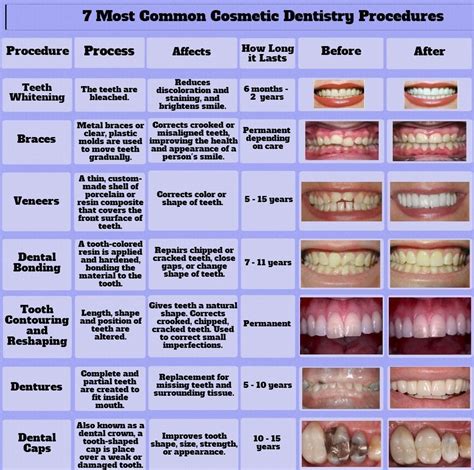 Most Common Cosmetic Dentistry Procedures | Cosmetic dentistry 