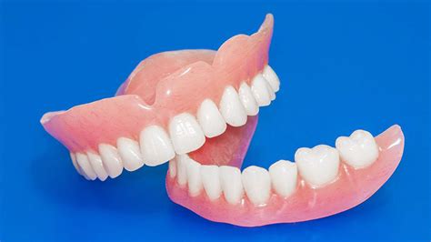Dentures Definition Types Advantages And How To Care For Them Ezza