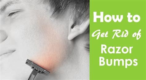 How To Get Rid Of Razor Bumps The Ultimate Guide Health Ambition