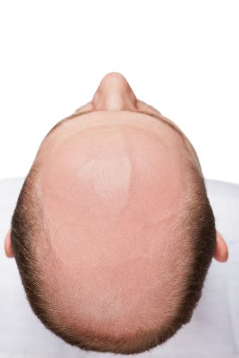 Bald Man Head Stock Photo Download Image Now Istock