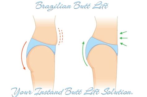 Brazilian Butt Lift Your Instant Butt Lift Solution Damidols