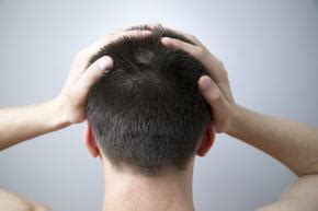 La dermatite del cuoio capelluto: come risolvere il disturbo