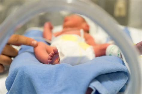 Neonatal Listeriosis Due To Prematurity Pledge Times