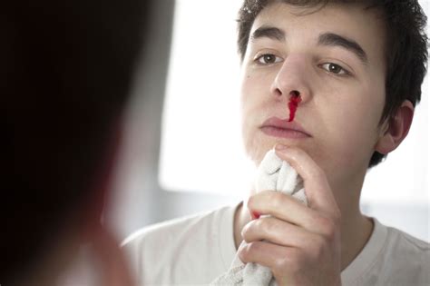 How To Stop A Nosebleed