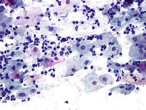 Cytopathology Of The Uterine Cervix Digital Atlas Uterine Cervix