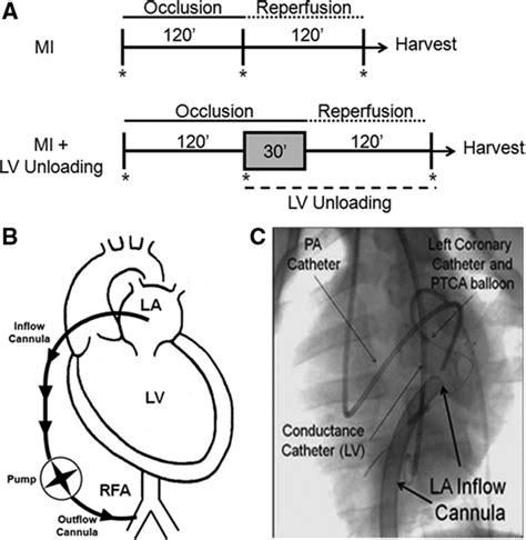 Mechanically Unloading The Left Ventricle Before Coronary Reperfusion
