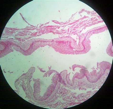 Urinary Bladder Histology Howmed Images
