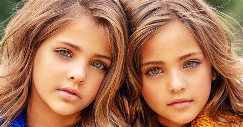 Vor 9 Jahren Nannten Sie Sie Die Schönsten Zwillinge Der Welt Sieh Sie