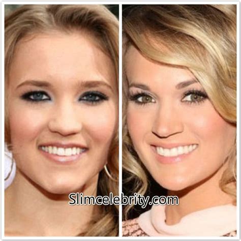 Carrie Underwood Plastic Surgery Before And After Find Photos Here