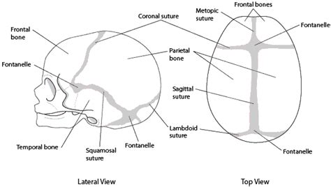 Sagittal Suture Craniosynostosis