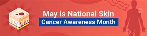 Skin Cancer Awareness Month 2024 What You Need Know