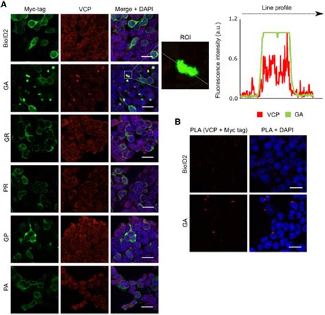 cellular localization of dprs and vcp in hek293 cells a hek293 cells download scientific