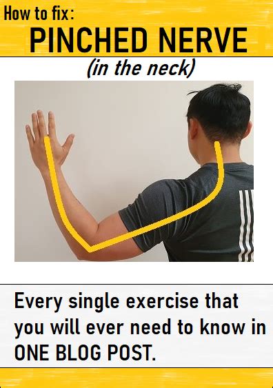 Pin On Exercises For A Pinched Nerve In The Neck