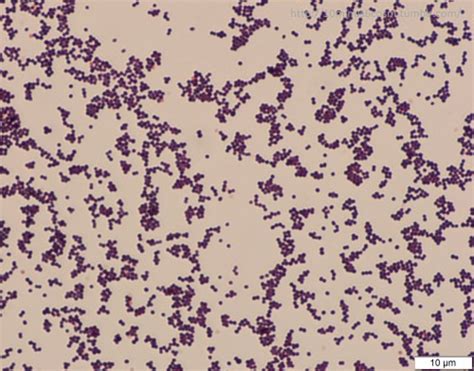 Microcosm Staphylococcus Lugdunensis And Singapore