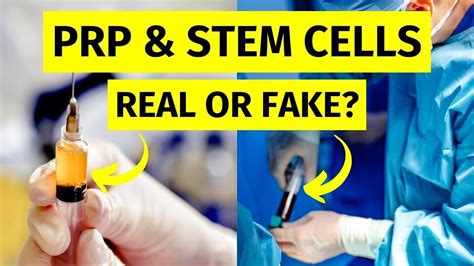 What Are Prp And Stem Cell Therapy An Introduction To Orthobiologics In Sports Medicine Stem