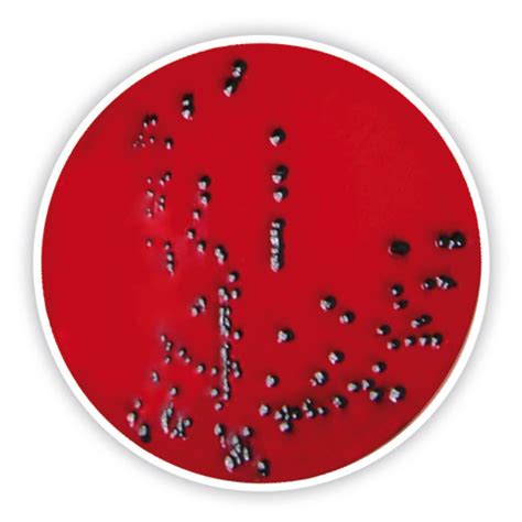 Salmonella On Xld Agar Plate Pics For Xld Agar Microbiology Medical
