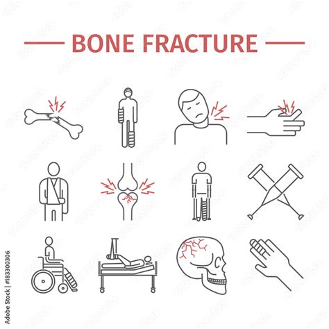 Bone Fractures Line Icons Treatment Infographic Vector Illustrations