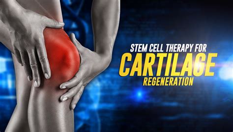 Progressive Rehabilitation Medicine Stem Cell Treatment For Cartilage