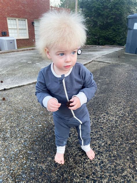 Mom Raises Awareness After Son Is Diagnosed With Uncombable Hair