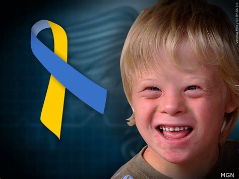 Coastal Bringing Up Down Syndrome To Celebrate World Down Syndrome Day
