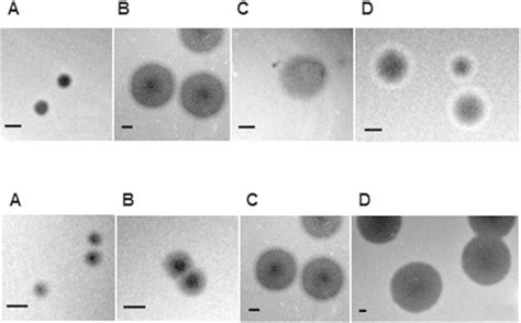 Examples Of Diversity Of Phage Plaque Morphology Upper Panels And