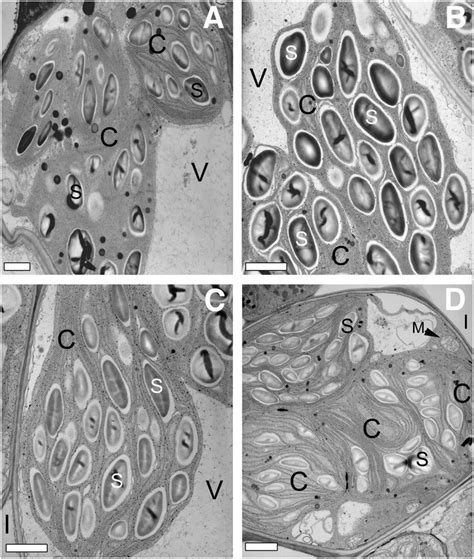 Transmission Electron Microscopy Of Bundle Sheath Cells In Uninjured