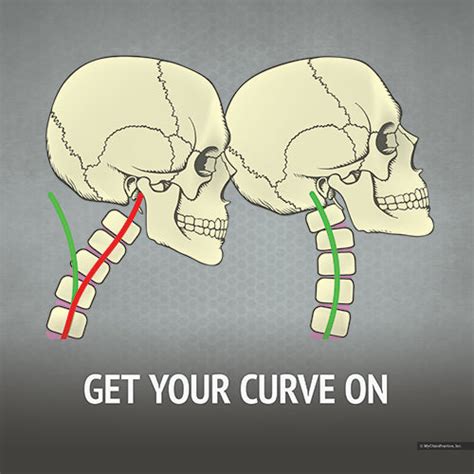 Cervical Curve Right Facing Chiropractic Biophysics