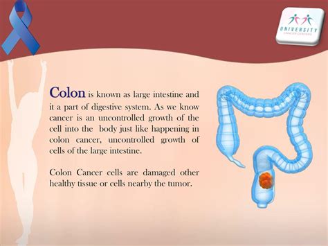 Ppt Learn Easily Symptoms Causes And Treatment Of Colon Cancer