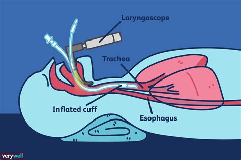 Anatomy Of Airway For Intubation Anatomical Charts Posters