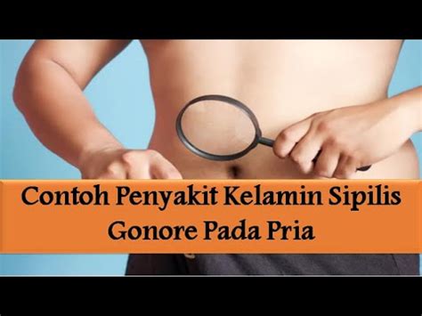 0877 3652 7305, dan tunggu respon cs kami. Contoh Penyakit Kelamin Sipilis Gonore Pada Pria - YouTube