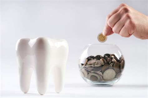 Many insurance policies cover at least part of the cost of a root canal. Are Root Canals Covered By Dental Insurance? | Lindemann RCS