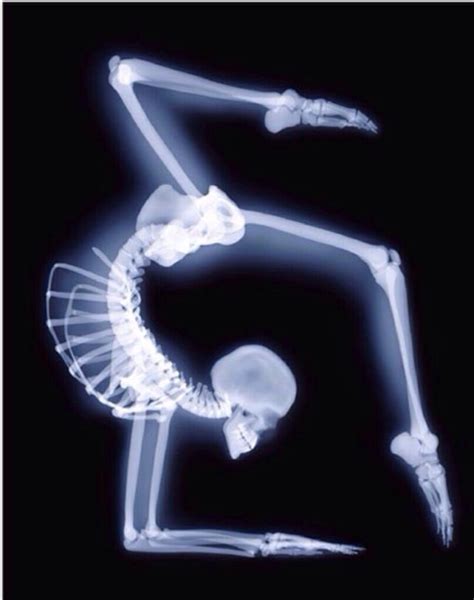 Graphic X Rays That Are So Shocking You Won T Believe The Patients Survived Thatviralfeed