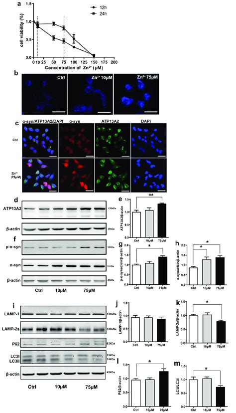 Effects Of Zn 2 On Atp13a2 α Synuclein And Autophagy Lysosome