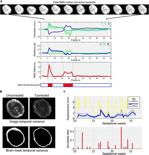 Frontiers Fetal Functional Imaging Portrays Heterogeneous Development Of Emerging Human Brain