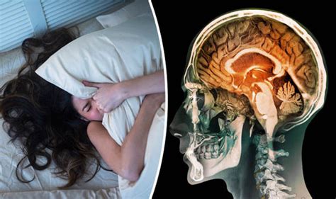 Alzheimers Sleep Problems Linked To High Risk Of Developing Disease